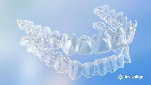 Invisalign_aligners