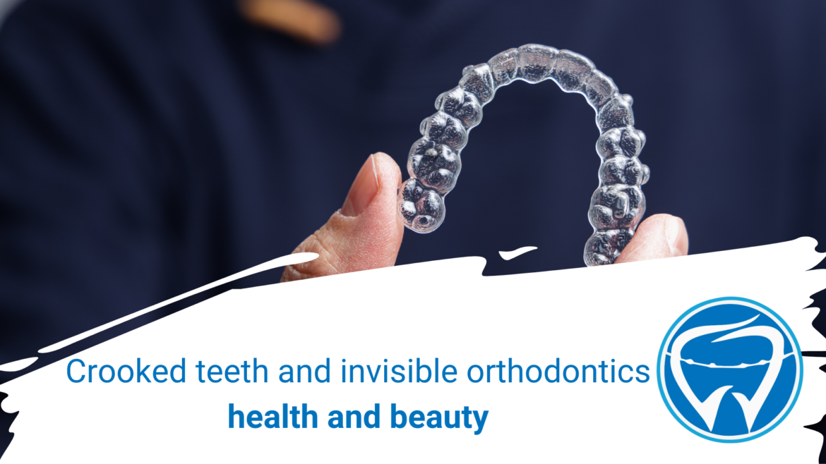 Crooked teeth and invisible orthodontics: health and beauty