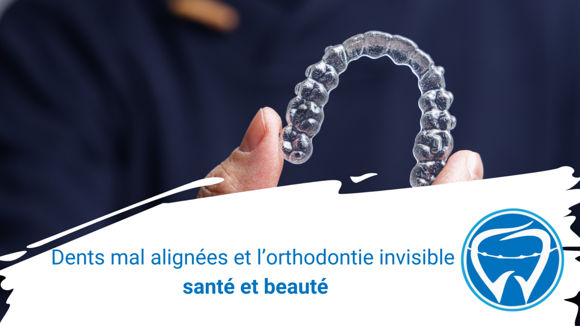 Dents mal alignées et l’orthodontie invisible : santé et beauté