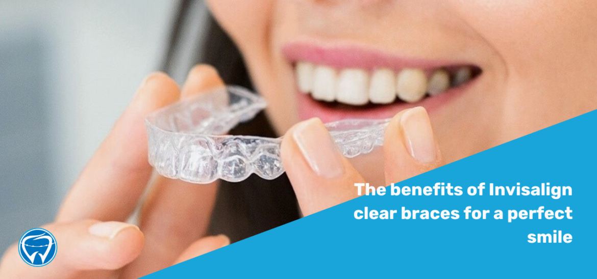 The benefits of Invisalign clear braces for a perfect smile