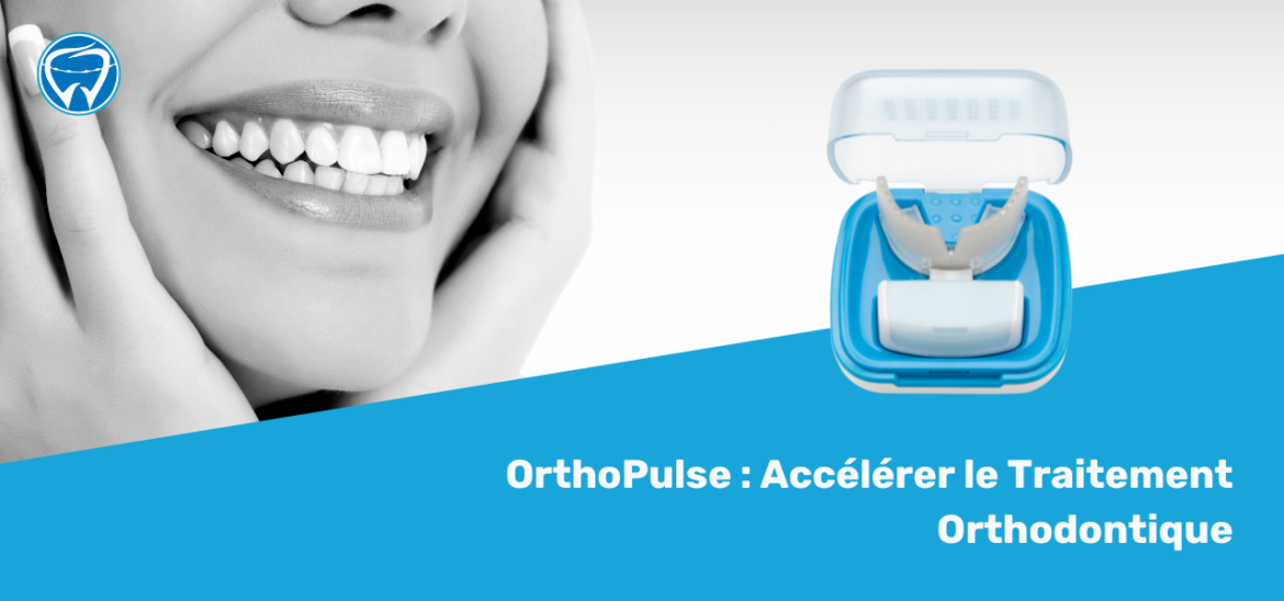 OrthoPulse : Accélérer le Traitement Orthodontique